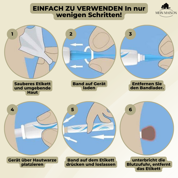 DermaLinx Fjern Vorter | Smertefri Fjernelse af Vorter og Modermærker | Til Hjemmebrug | Uden Kirurgi
