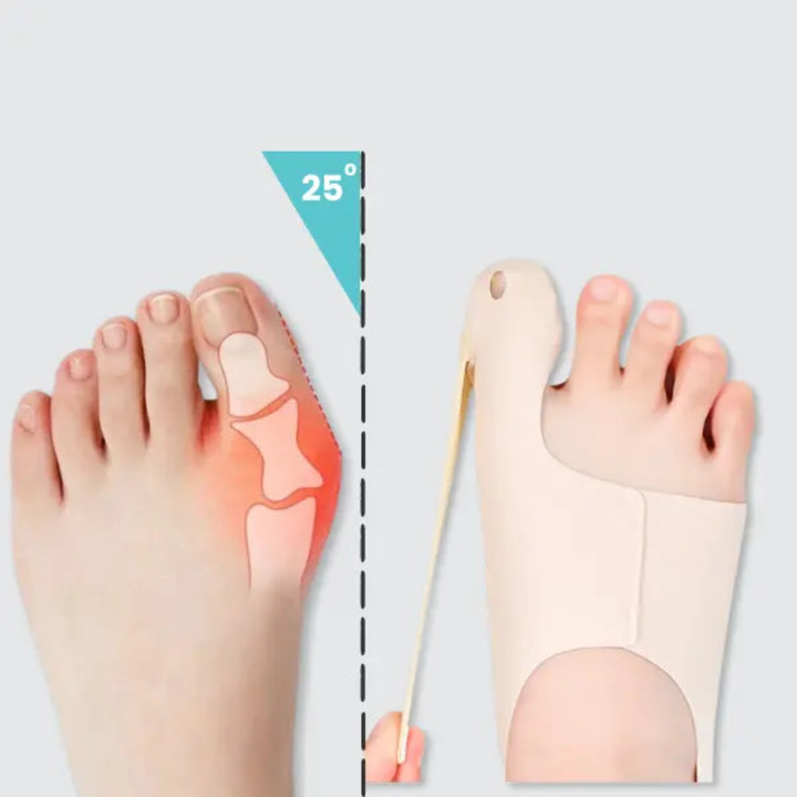 Hallux Korrektor Ærme