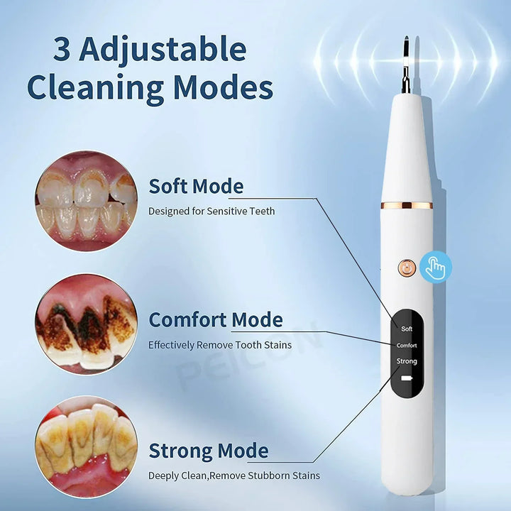Ultralyd tandrenser - SonicClean