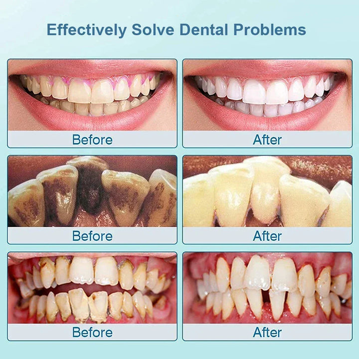 Ultralyd tandrenser - SonicClean