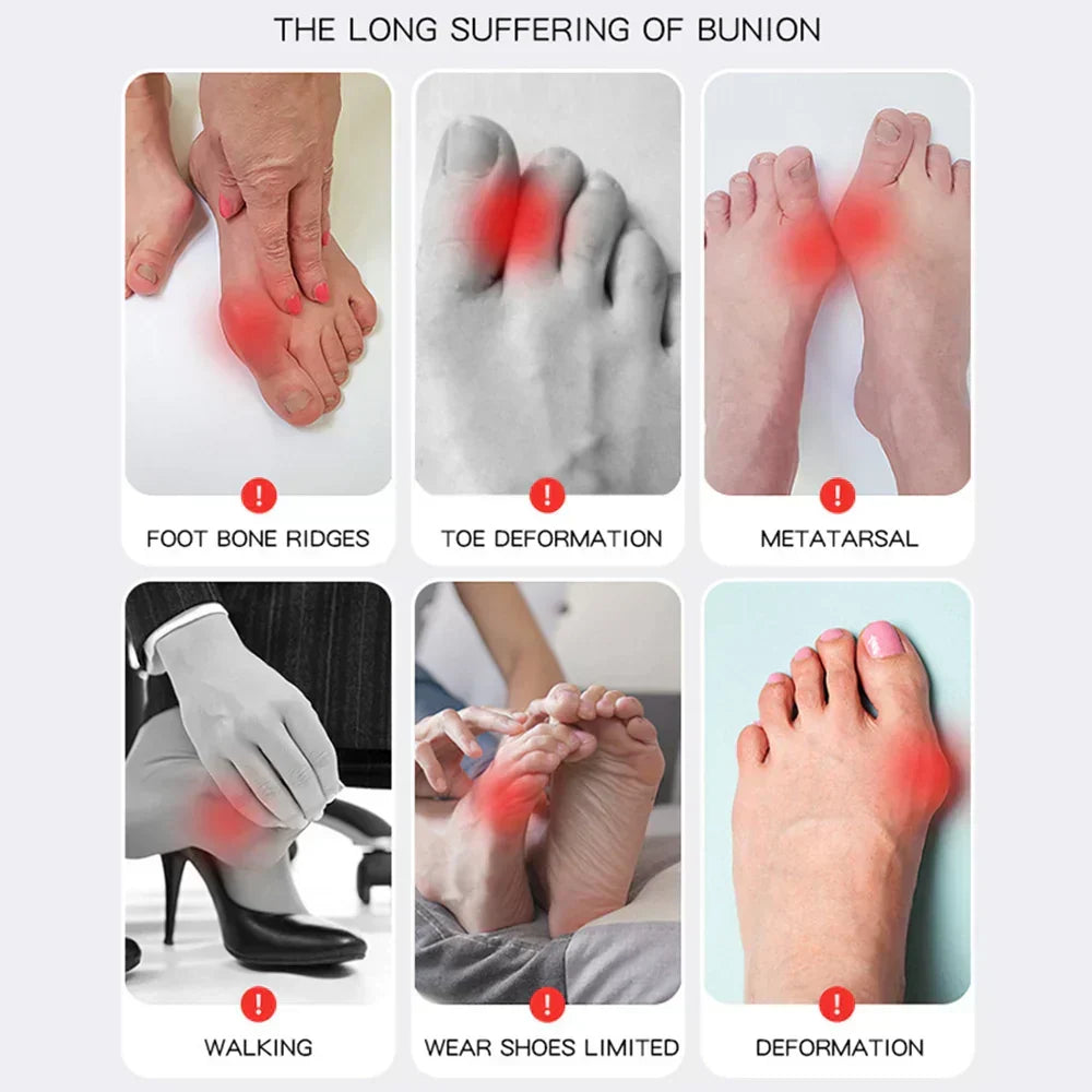1+1 GRATIS | Hallux Valgus™ | Din komfortable løsning til smertefrie fødder!