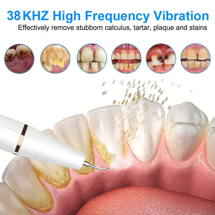 Ultralyd tandrenser - SonicClean
