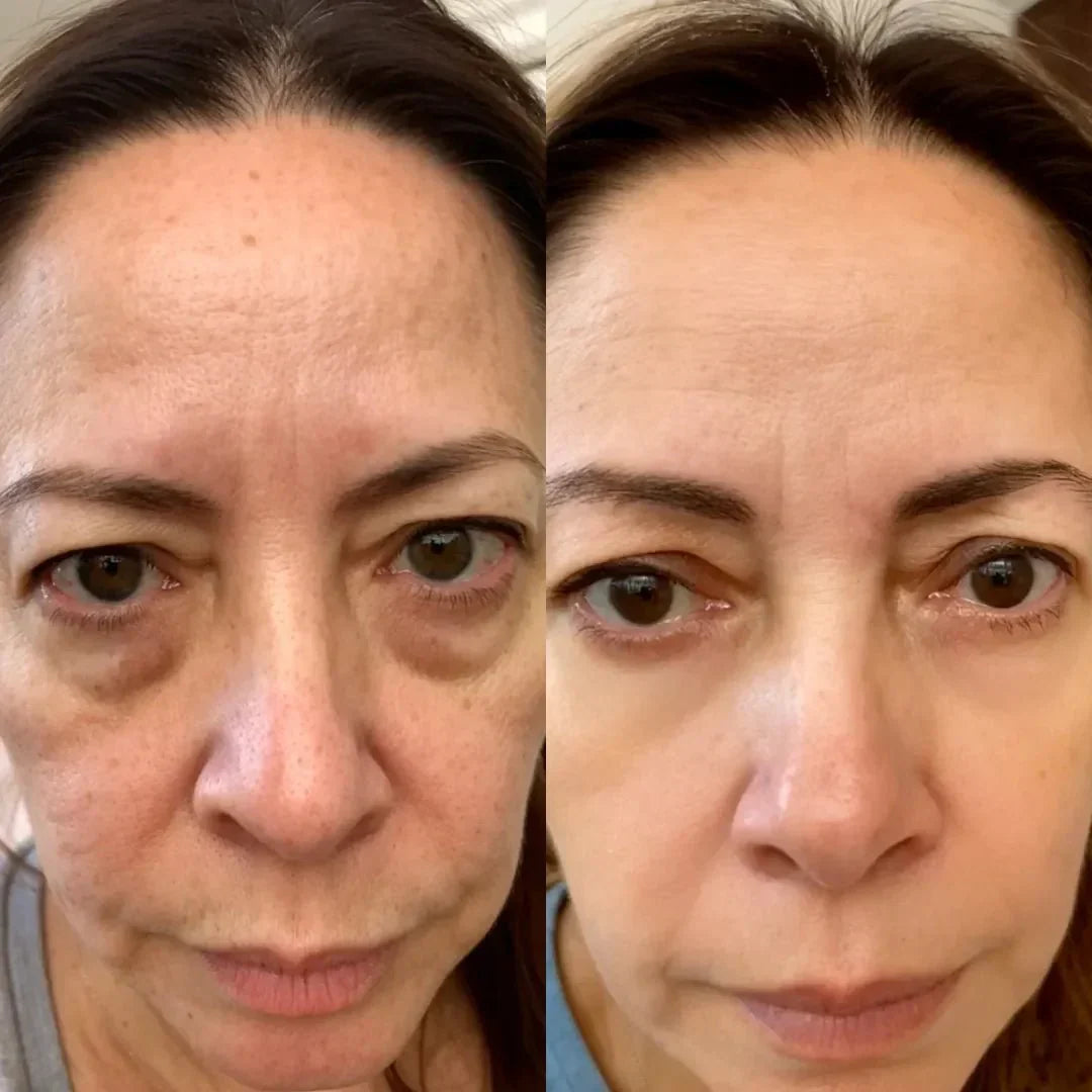 LumaNova Eye Rejuvenator til Rødlysterapi og Mikrostrøm