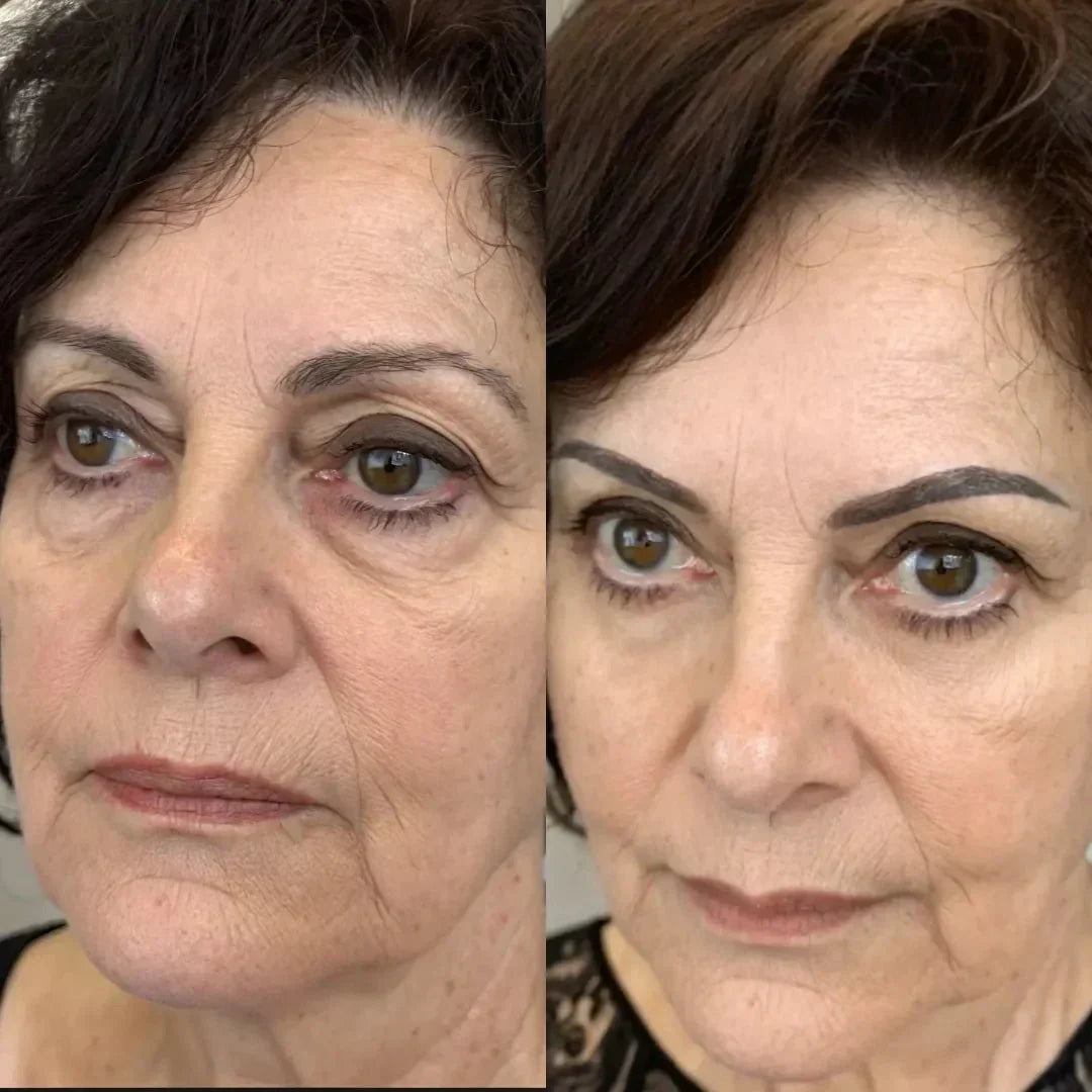 LumaNova Eye Rejuvenator til Rødlysterapi og Mikrostrøm