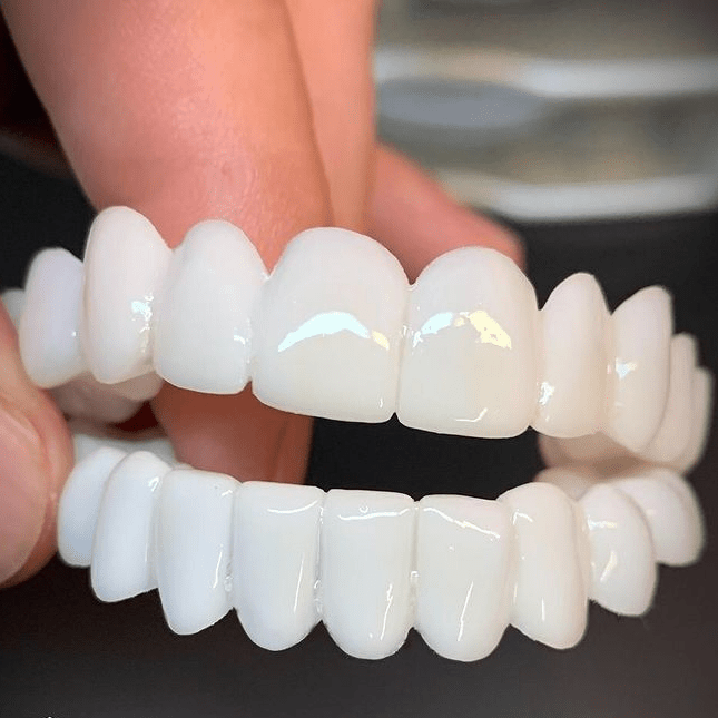SmileFlex – Tilpasselig tandprotese med tandskaller
