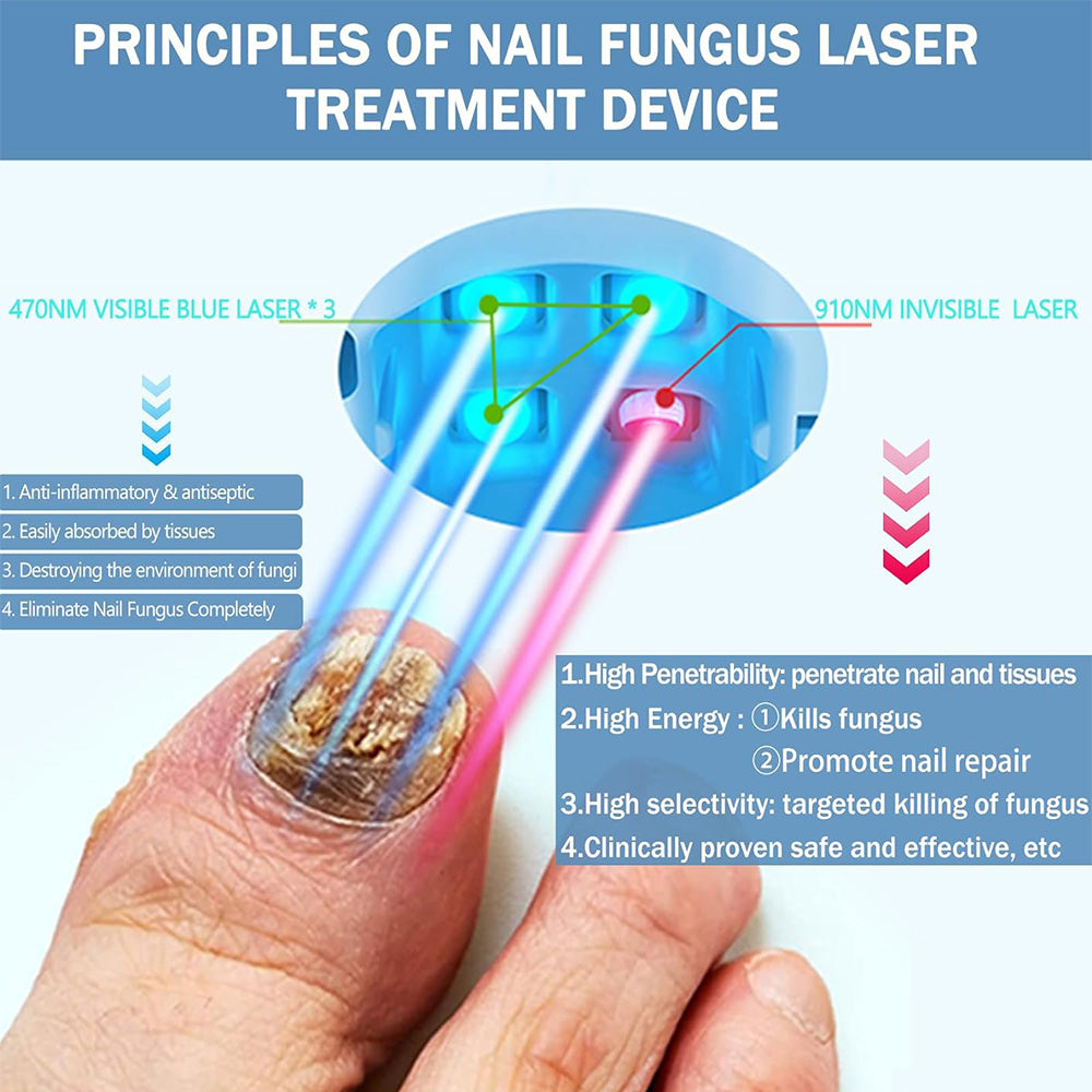 NexaLume brugervenligt lasernegleplejeapparat