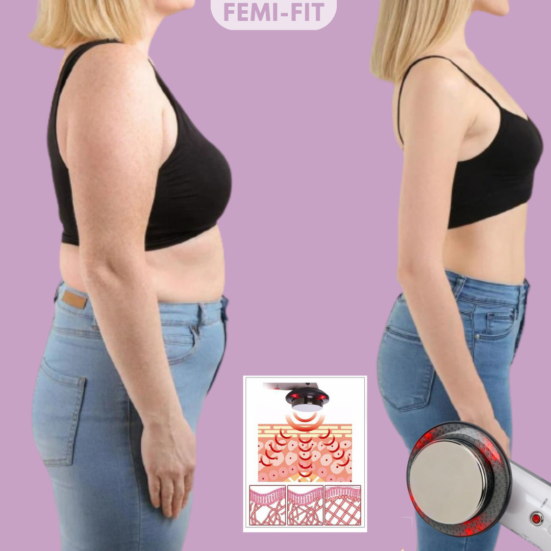 Fjern fedt og cellulitis 3-i-1 – SlimShape
